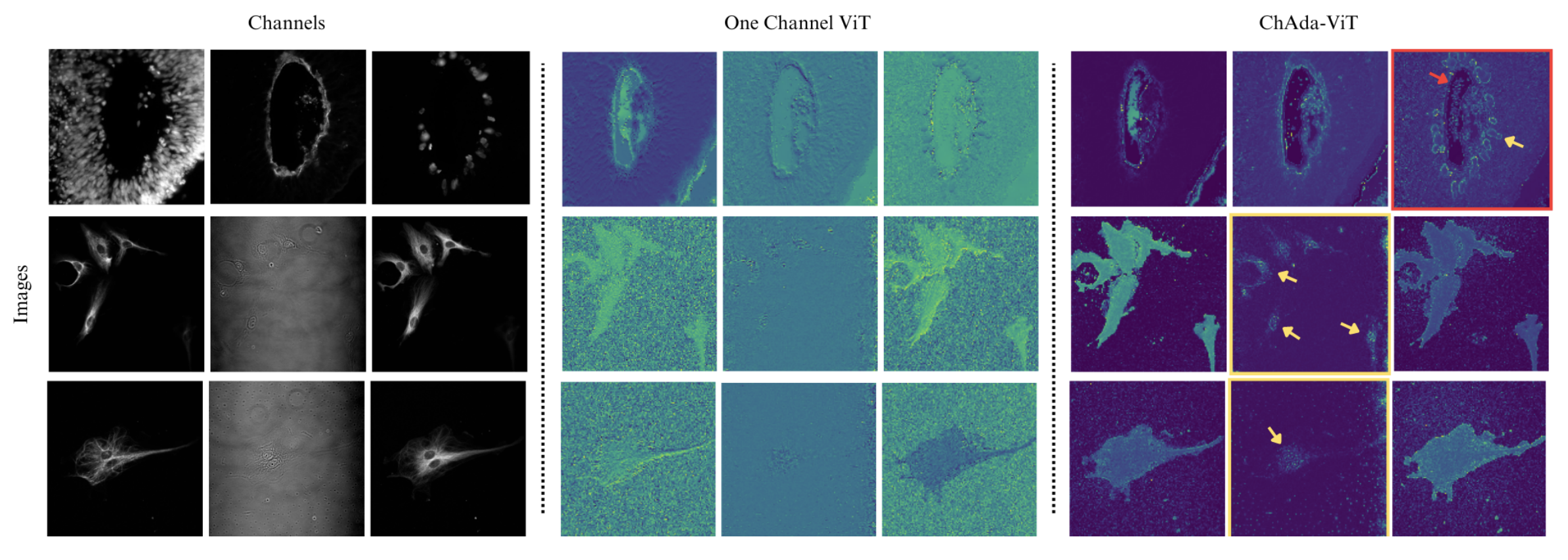 Vizualization of attention maps